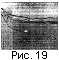 fig19